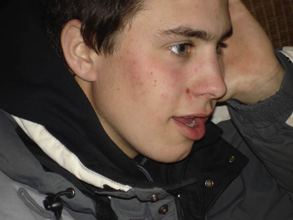 2tophe Baatard
